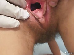 Angela have pussy speculum examined by gyno doctor